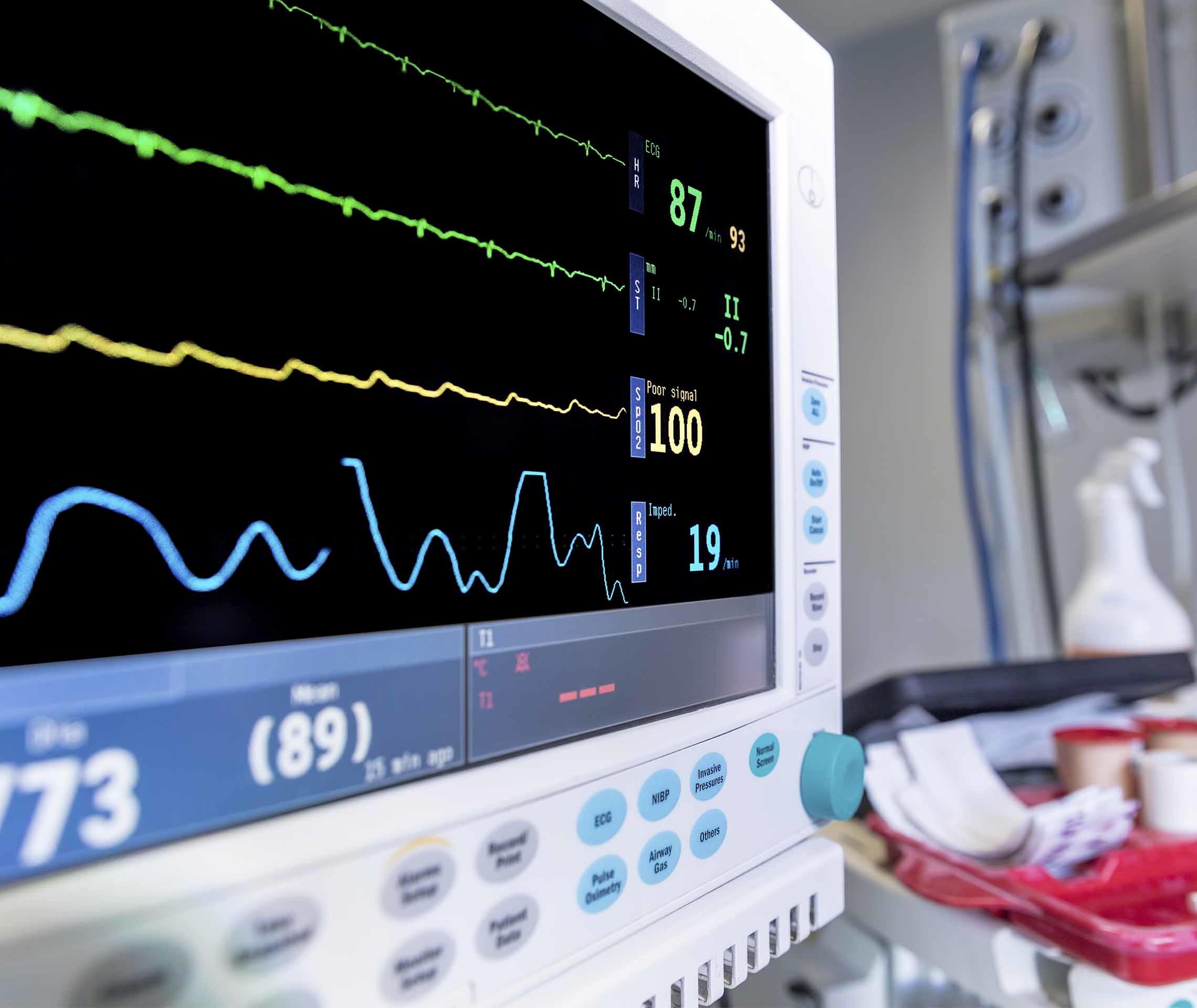 Transplantation verstehen: Auf einem Montitor sind verschiedene Herzwerte zu eines Patienten zu sehen