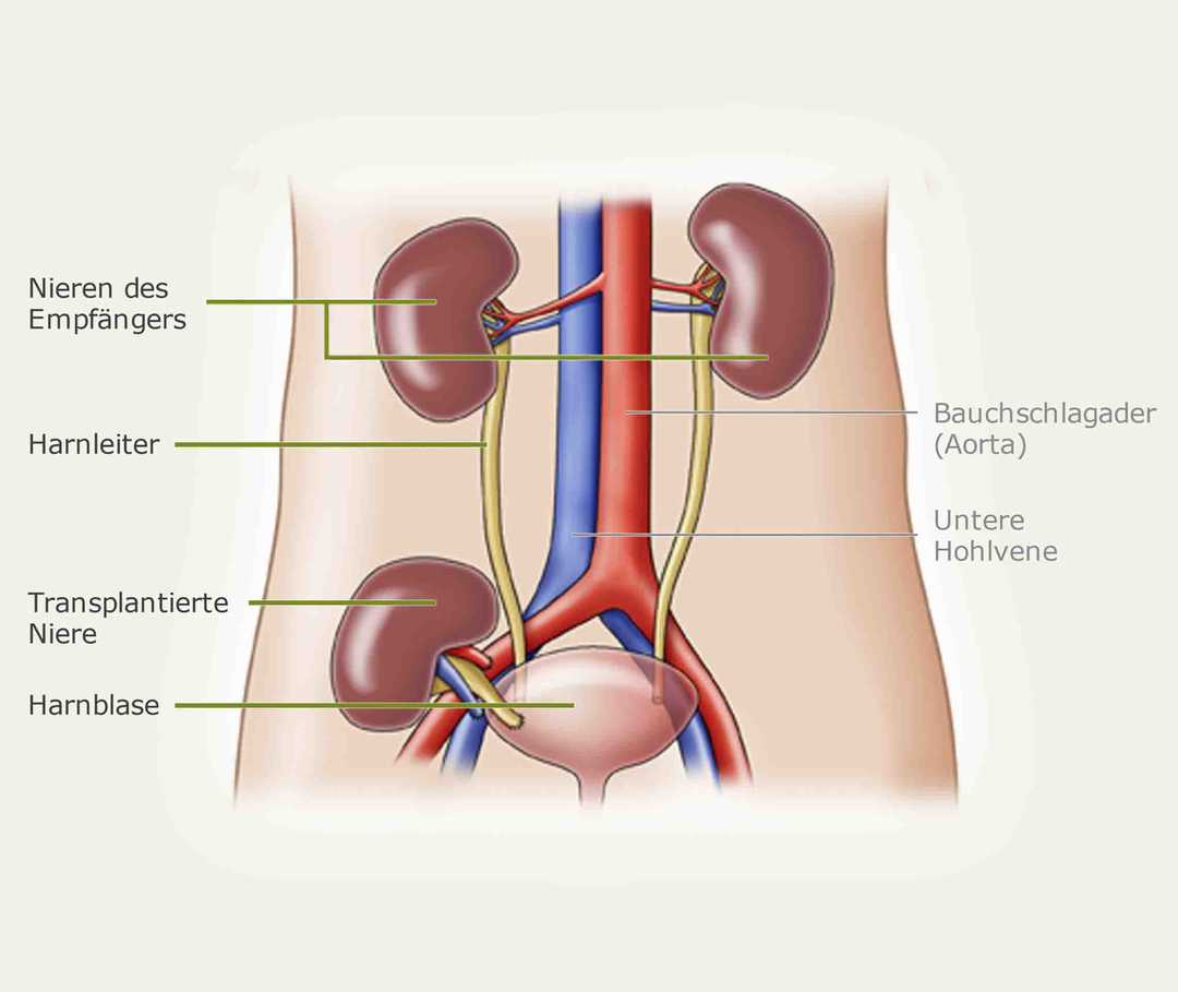 Schaubild Lage Organe Nierentransplantation-Operation