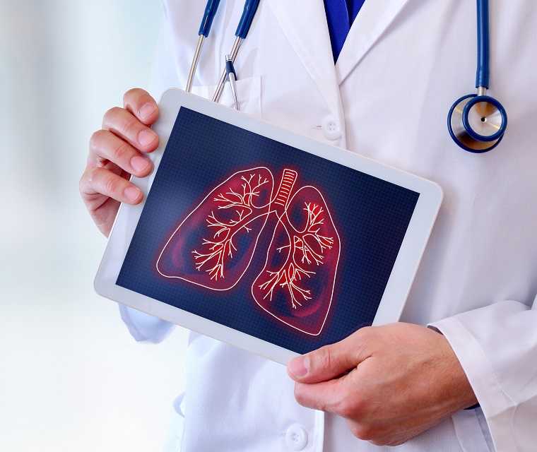Arzt hält ein Tablet, auf dem eine Lunge zu sehen ist, in der Hand